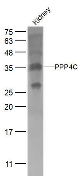 PPP4C Rabbit Polyclonal Antibody