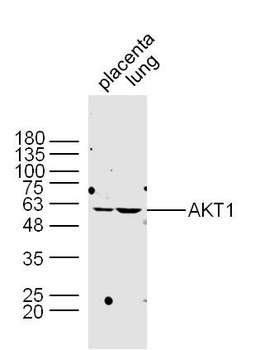 AKT1 Rabbit Polyclonal Antibody