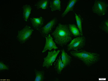 AKT1 Rabbit Polyclonal Antibody
