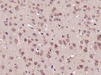 Phospho-AKT (Ser473) Rabbit Polyclonal Antibody