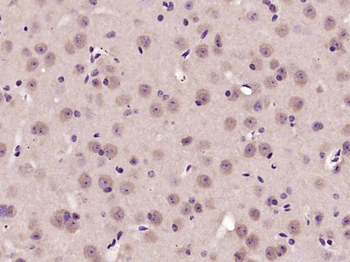 Phospho-AKT (Ser473) Rabbit Polyclonal Antibody