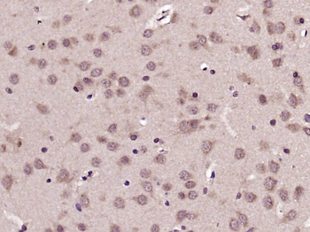 Phospho-AKT (Ser473) Rabbit Polyclonal Antibody