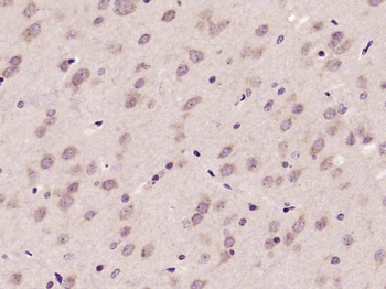 Phospho-AKT (Ser473) Rabbit Polyclonal Antibody