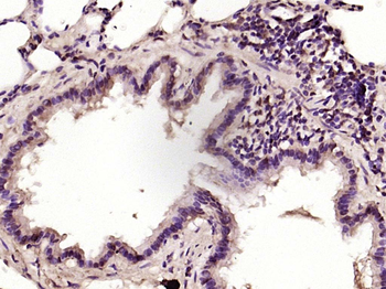 Phospho-AKT (Ser473) Rabbit Polyclonal Antibody