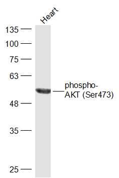 Phospho-AKT (Ser473) Rabbit Polyclonal Antibody