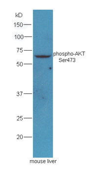 Phospho-AKT (Ser473) Rabbit Polyclonal Antibody