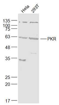 EIF2AK2 (PKR) Rabbit Polyclonal Antibody