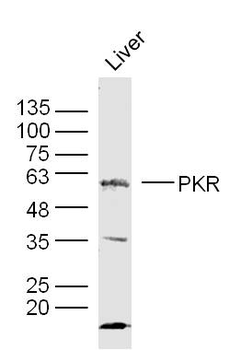EIF2AK2 (PKR) Rabbit Polyclonal Antibody