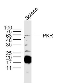 EIF2AK2 (PKR) Rabbit Polyclonal Antibody