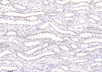 AKT2 Rabbit Polyclonal Antibody