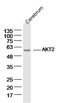 AKT2 Rabbit Polyclonal Antibody