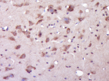 Presenilin 1 Rabbit Polyclonal Antibody