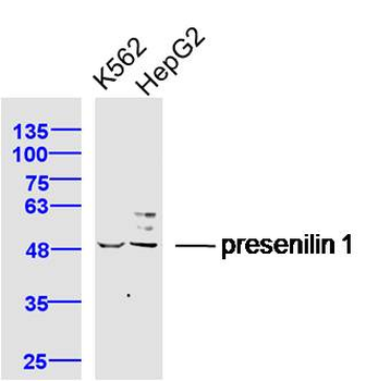 Presenilin 1 Rabbit Polyclonal Antibody