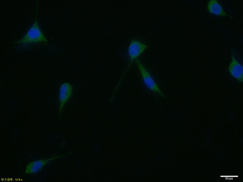 Presenilin 1 Rabbit Polyclonal Antibody