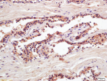 PSA (Pa3) Mouse Monoclonal Antibody