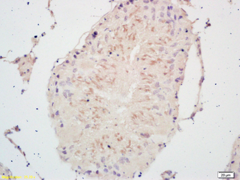 PSCA Rabbit Polyclonal Antibody