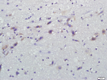 PSD95 Rabbit Polyclonal Antibody