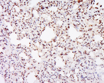 PTEN Rabbit Polyclonal Antibody
