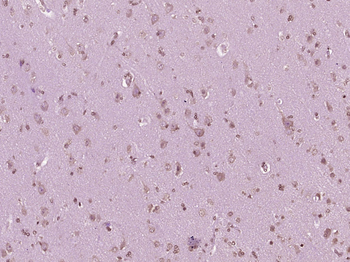 PTEN Rabbit Polyclonal Antibody