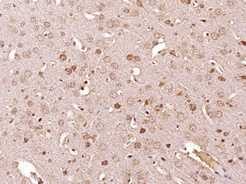 PTEN Rabbit Polyclonal Antibody