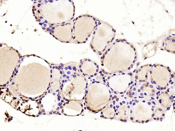 PTEN Rabbit Polyclonal Antibody