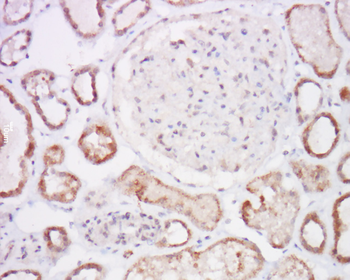 PTEN Rabbit Polyclonal Antibody