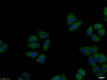 PTPN1 Rabbit Polyclonal Antibody