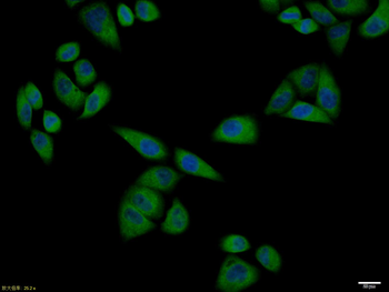 PTPN1 Rabbit Polyclonal Antibody