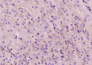 PTPN1 Rabbit Polyclonal Antibody