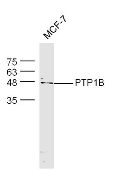 PTPN1 Rabbit Polyclonal Antibody