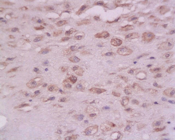 PTPN1 Rabbit Polyclonal Antibody