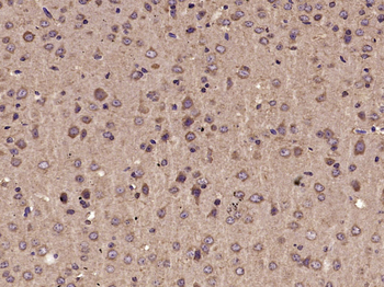 Parvalbumin Rabbit Polyclonal Antibody