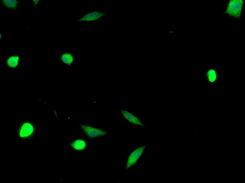 RAR alpha Rabbit Polyclonal Antibody