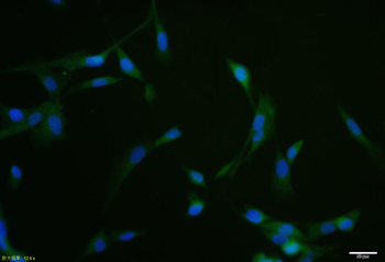 RARB Rabbit Polyclonal Antibody