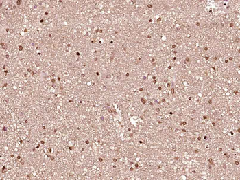 RARB Rabbit Polyclonal Antibody