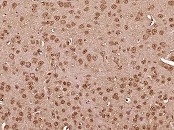 RARB Rabbit Polyclonal Antibody