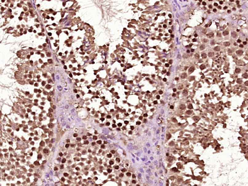 RARB Rabbit Polyclonal Antibody