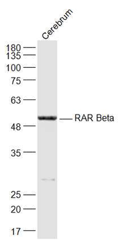 RARB Rabbit Polyclonal Antibody