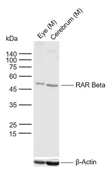 RARB Rabbit Polyclonal Antibody