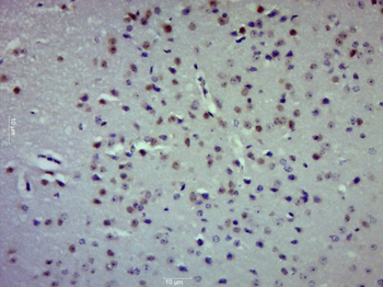 RASSF1A Rabbit Polyclonal Antibody