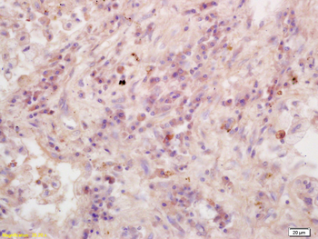 RASSF1A Rabbit Polyclonal Antibody