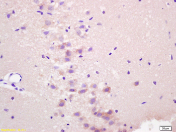 RASSF1A Rabbit Polyclonal Antibody