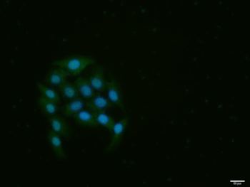 Phospho-Rb (Ser780) Rabbit Polyclonal Antibody