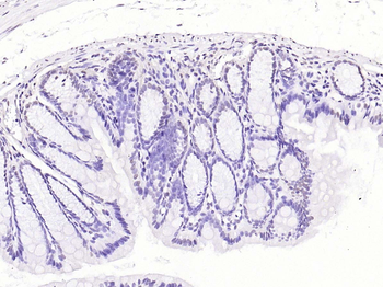 Phospho-Rb (Ser780) Rabbit Polyclonal Antibody