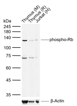 Phospho-Rb (Ser780) Rabbit Polyclonal Antibody
