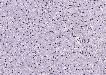 S100B Rabbit Polyclonal Antibody