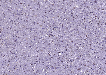 S100B Rabbit Polyclonal Antibody