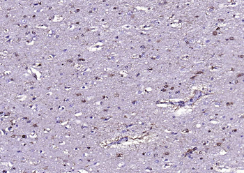 S100B Rabbit Polyclonal Antibody