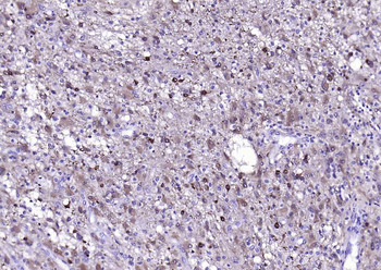 S100B Rabbit Polyclonal Antibody