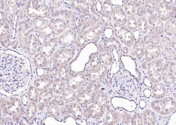 SFRP1 Rabbit Polyclonal Antibody